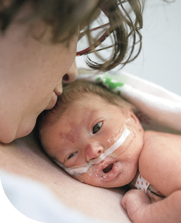 A baby with monitoring devices and feeding lines attached laying their head against mom's chest while mom kisses baby's head